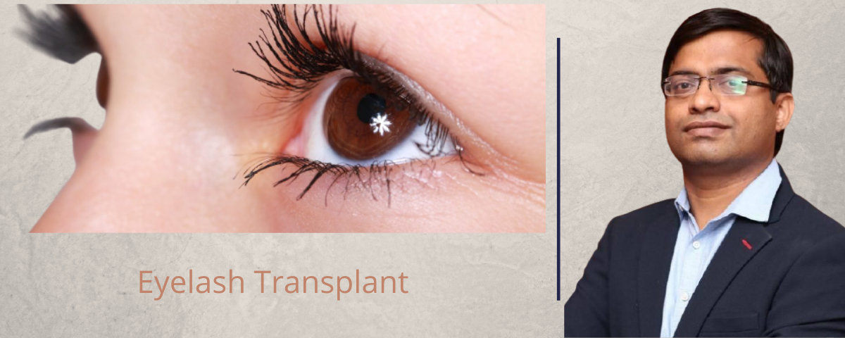 Eyelash Transplant and Implant Procedure