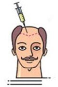 step2