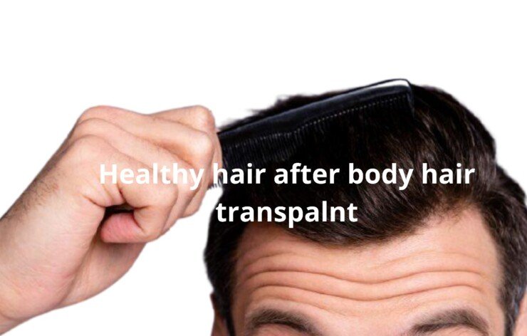 Image for body hair transplant