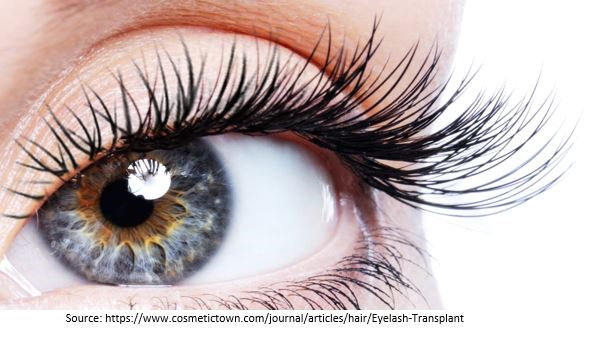 Eyelash hair transplant