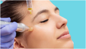 mesotherapy