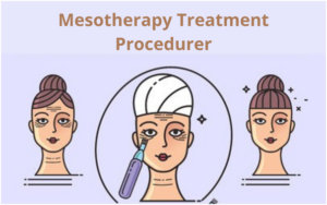mesotherapy procedure