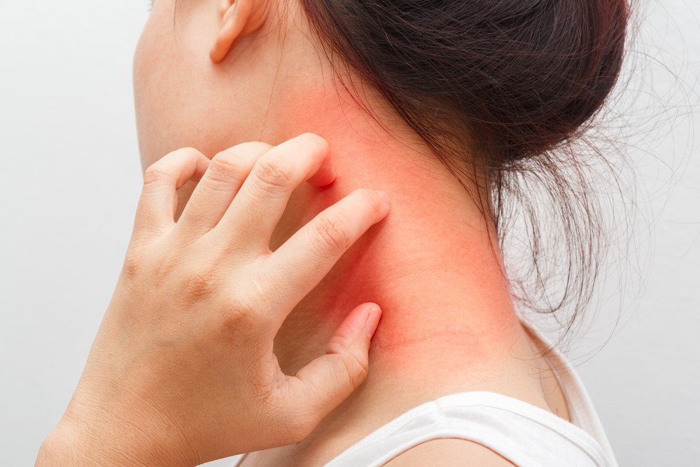 skin allergy treatment in vasant kunj