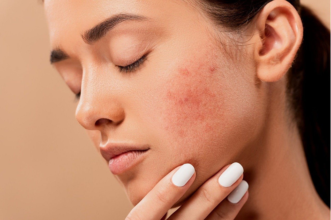 skin allergy in delhi