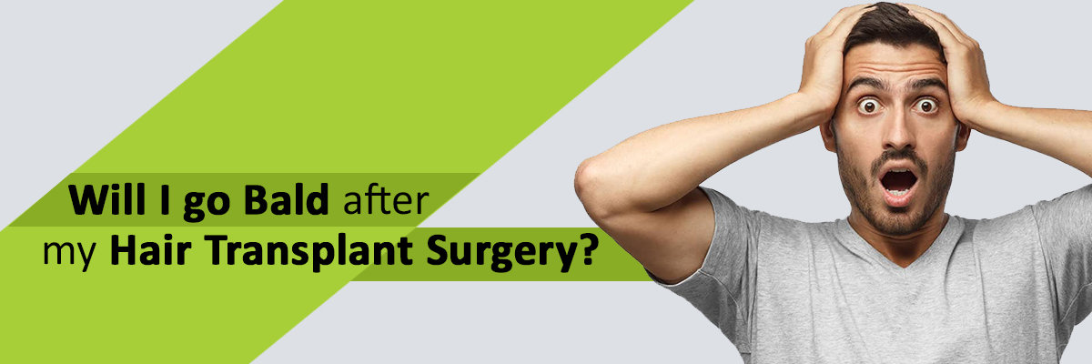 Will I go Bald after my Hair Transplant Surgery? Will I go Bald after my Hair Transplant Surgery?
