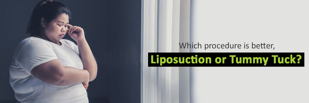 Which procedure is better, Liposuction or Tummy Tuck?