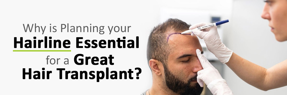 Why is Planning your Hairline Essential for a Great Hair Transplant Why is Planning your Hairline Essential for a Great Hair Transplant