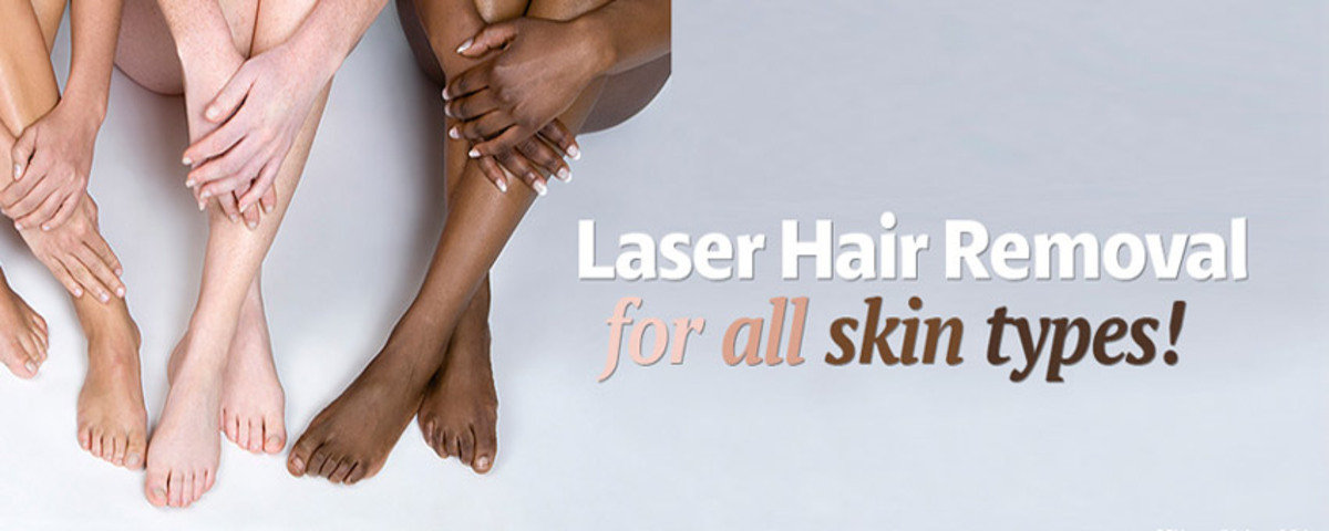 Laser hair removal