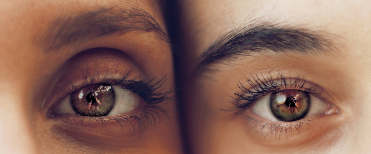 Eyelash hair transplant Eyelash hair transplant