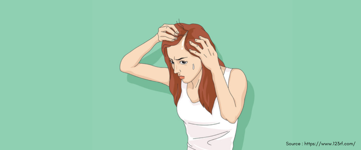 Hair Loss in Women Hair Loss in Women