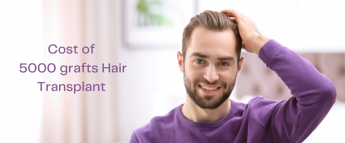 5000 grafts hair transplant 5000 grafts hair transplant