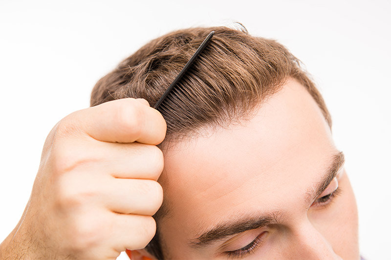 hair transplant cost