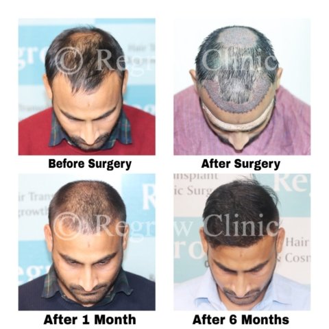 Before after Images Before after Images