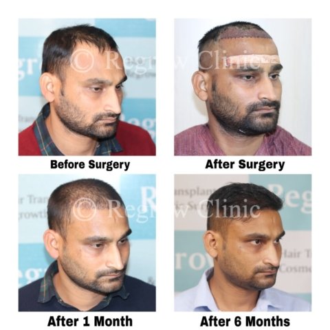 Before after Images Before after Images