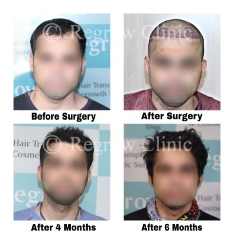 Before after Images Before after Images