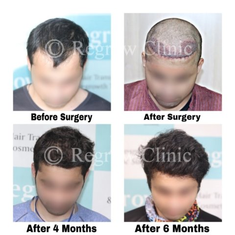 Before after Images Before after Images