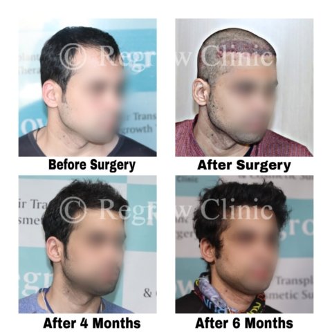 Before after Images Before after Images