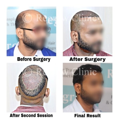 Before after Images Before after Images