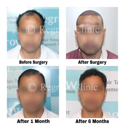 Before after Images Before after Images