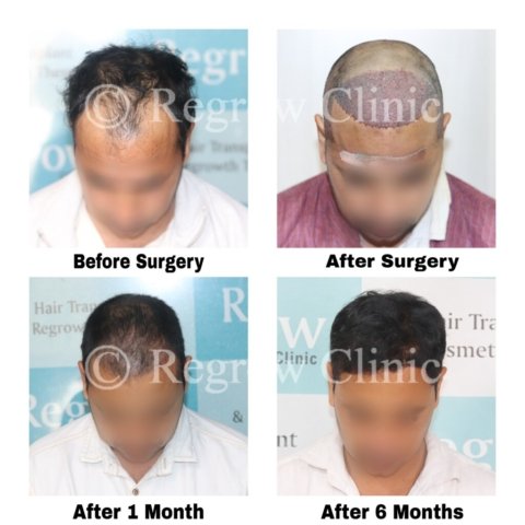Before after Images Before after Images