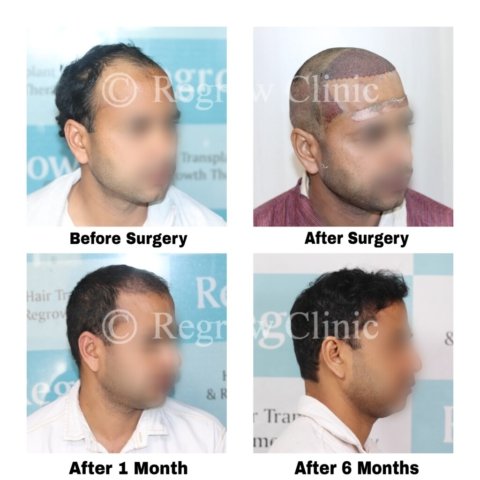 Before after Images Before after Images