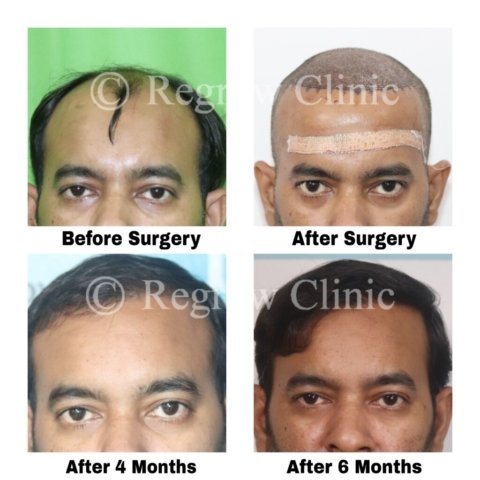 Before after Images Before after Images