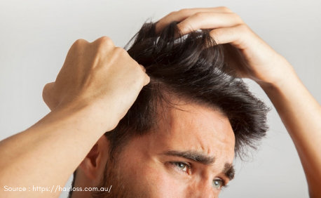 Male Hair Transplant