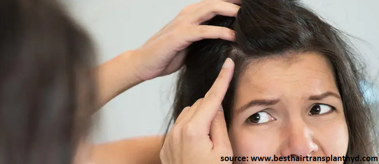 hair loss treatment