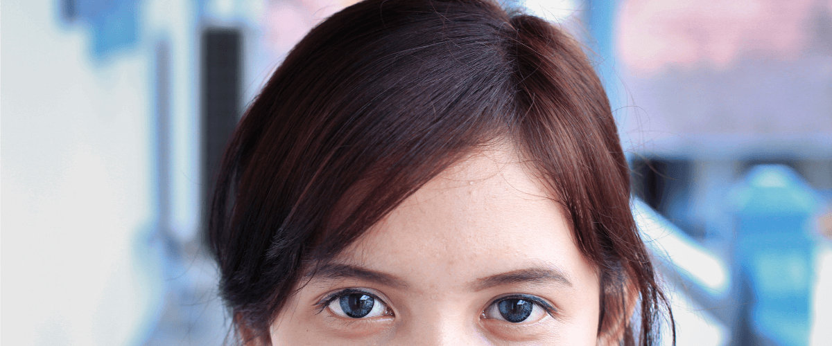 DHI Hair Transplant in India DHI Hair Transplant in India