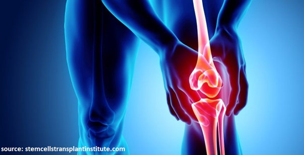 Osteoarthritis treatment by Dr Rishabh