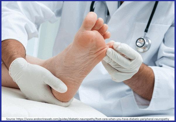 Conservative diabetic foot treatment
