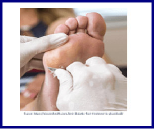 Podiatry care