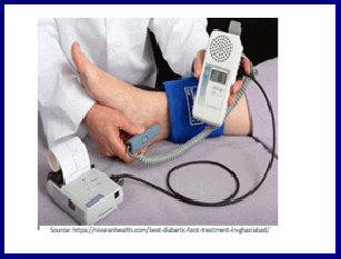 Digital biothesiometer -VPT
