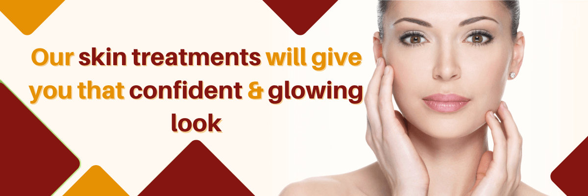 Acne Scars Treatment