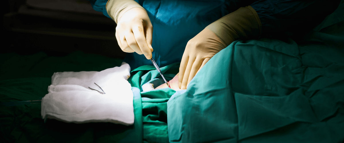 Laparoscopic Surgery Vs Open Surgery