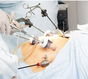 Laparoscopic Surgery