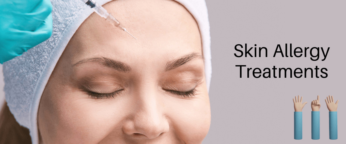common skin allergy common skin allergy