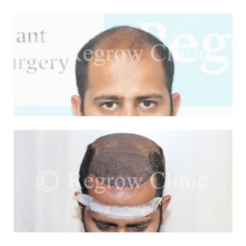 Before - After Surgery Images of Patients Before - After Surgery Images of Patients