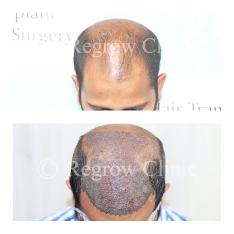 Before - After Surgery Images of Patients Before - After Surgery Images of Patients