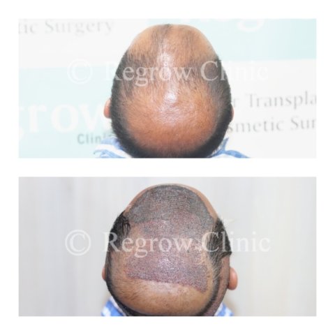 Before - After Surgery Images of Patients Before - After Surgery Images of Patients