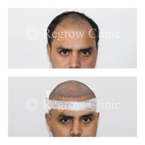 Before - After Surgery Images of Patients Before - After Surgery Images of Patients