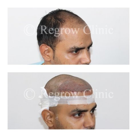 Before - After Surgery Images of Patients Before - After Surgery Images of Patients