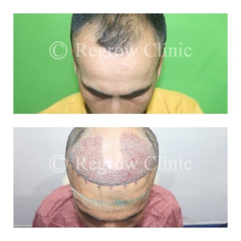 Before - After Surgery Images of Patients Before - After Surgery Images of Patients