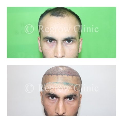 Before - After Surgery Images of Patients Before - After Surgery Images of Patients