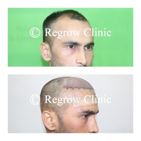 Before - After Surgery Images of Patients Before - After Surgery Images of Patients
