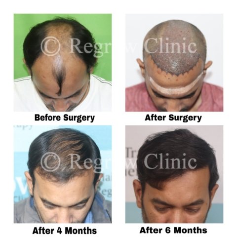 Before - After Images of Patients Before - After Images of Patients