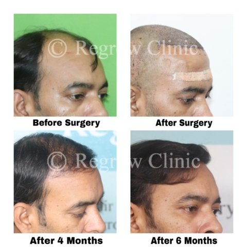 Before - After Images of Patients Before - After Images of Patients