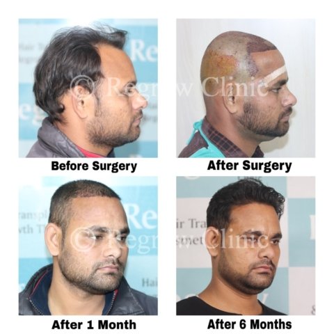 Before - After Treatment Images of Patients Before - After Treatment Images of Patients