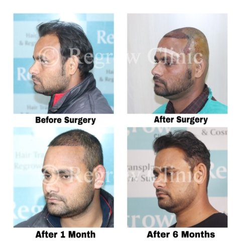 Before - After Treatment Images of Patients Before - After Treatment Images of Patients