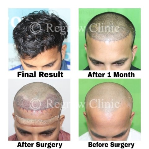 Before - After Treatment Images of Patients Before - After Treatment Images of Patients
